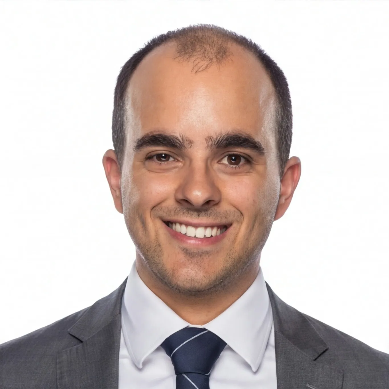 Hair loss simulation