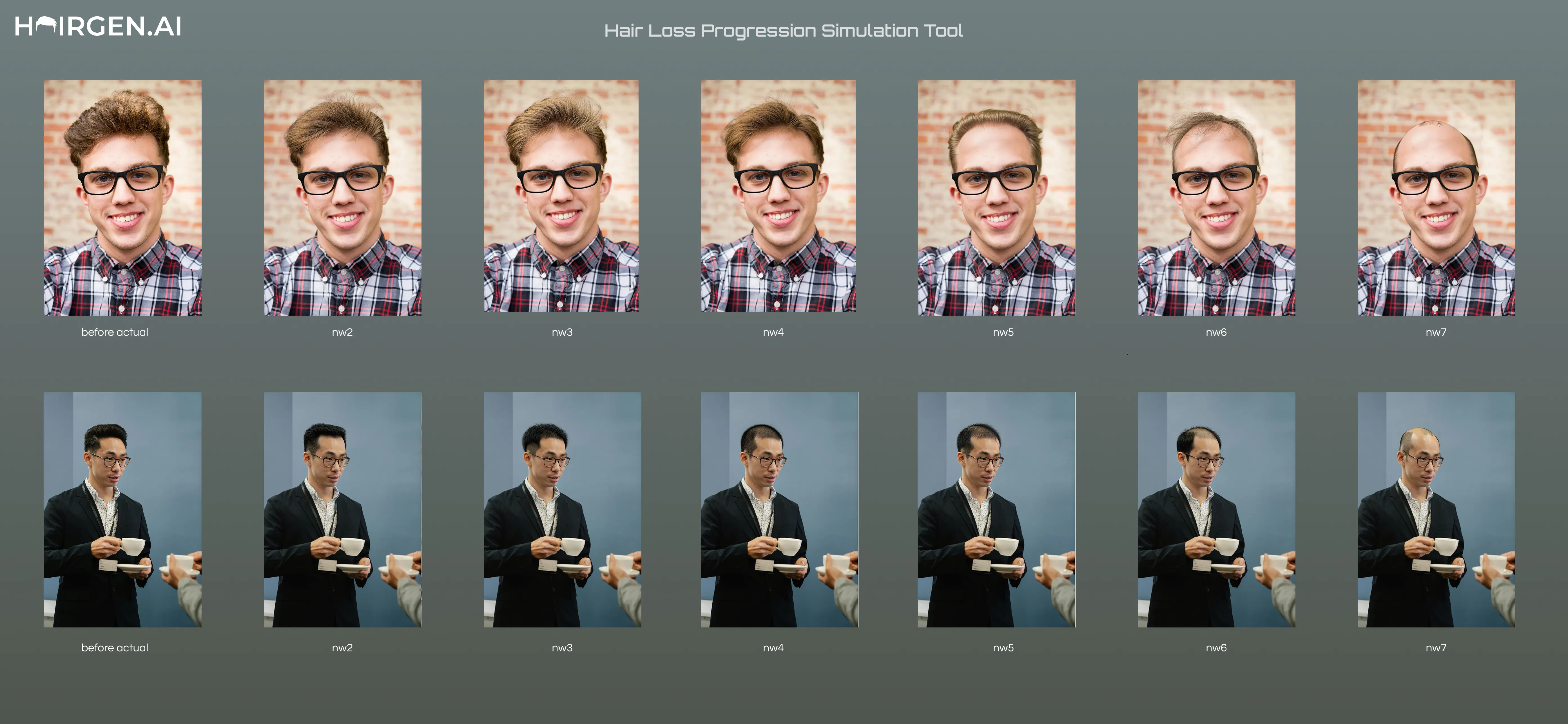 Hair Loss Progression Simulation